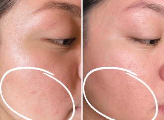 Your skincare products may be making your sensitive skin worse. Now what?