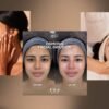 MOLD Manila Pioneers Holistic Skincare in the Philippines with Exclusive Brand Offerings